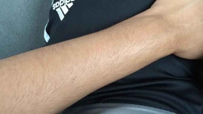 Are my arms hairy?