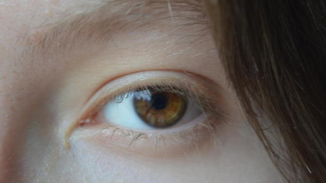 What are my eye color?