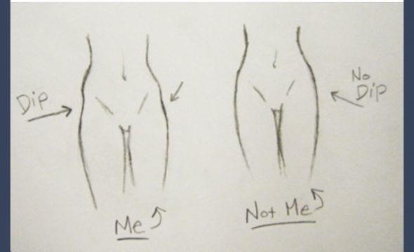 Are hip dips really that unattractive?