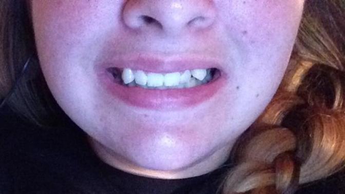 Guys, Do guys hate messed up teeth?