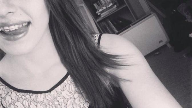 Do braces, plates, any orthodontics, make a person unattractive and put you off completely?