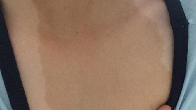 Guys, Is this birthmark ugly?