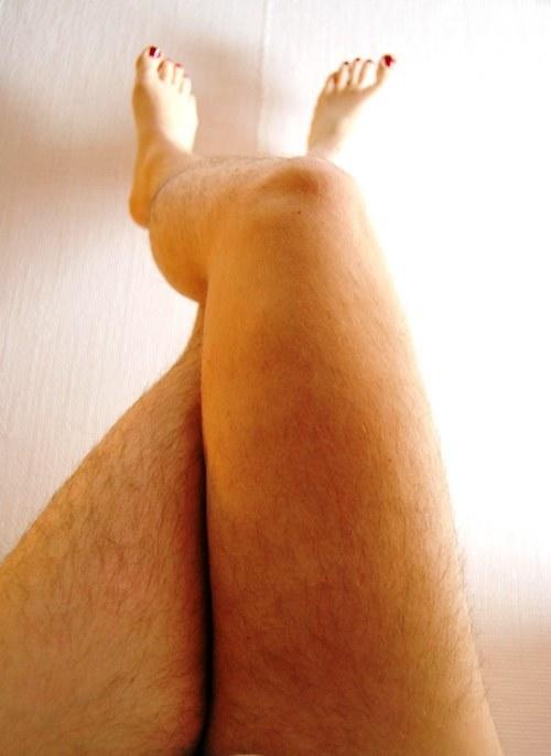Girls, do you dare to show off your legs like this?