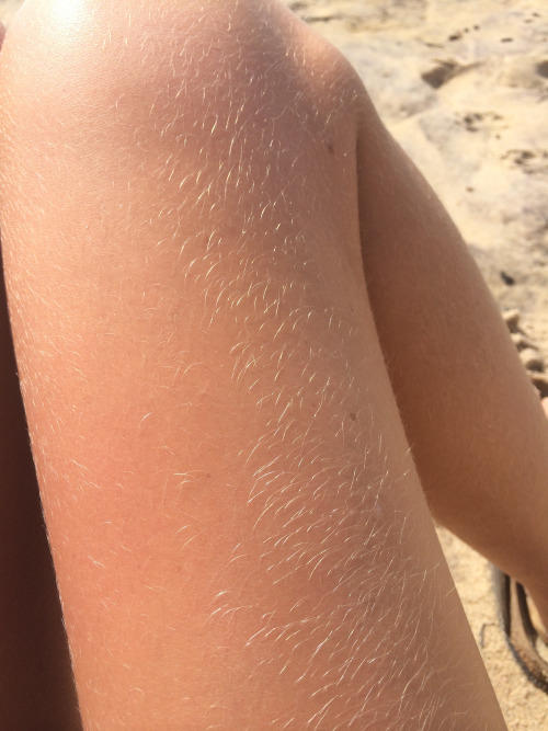 Girls, do you dare to show off your legs like this?