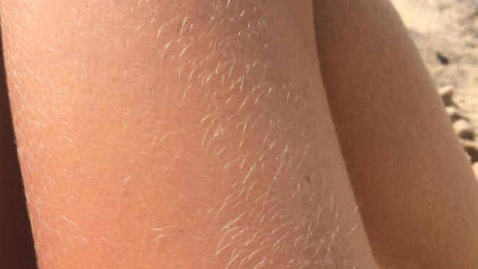 Girls, do you dare to show off your legs like this?