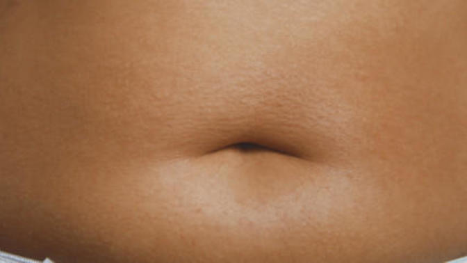 Would you date a woman with a muffin top/stomach bulge?