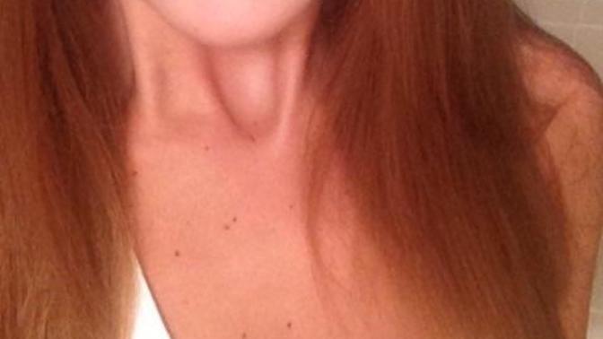 Are my chubby cheeks unattractive?