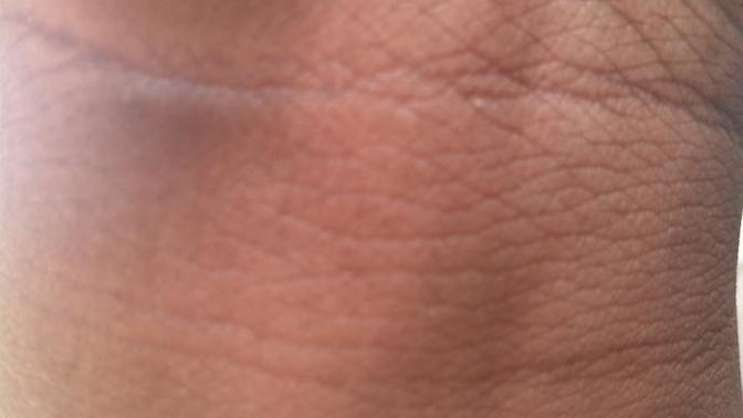 What's with some caucasians and tan lines?