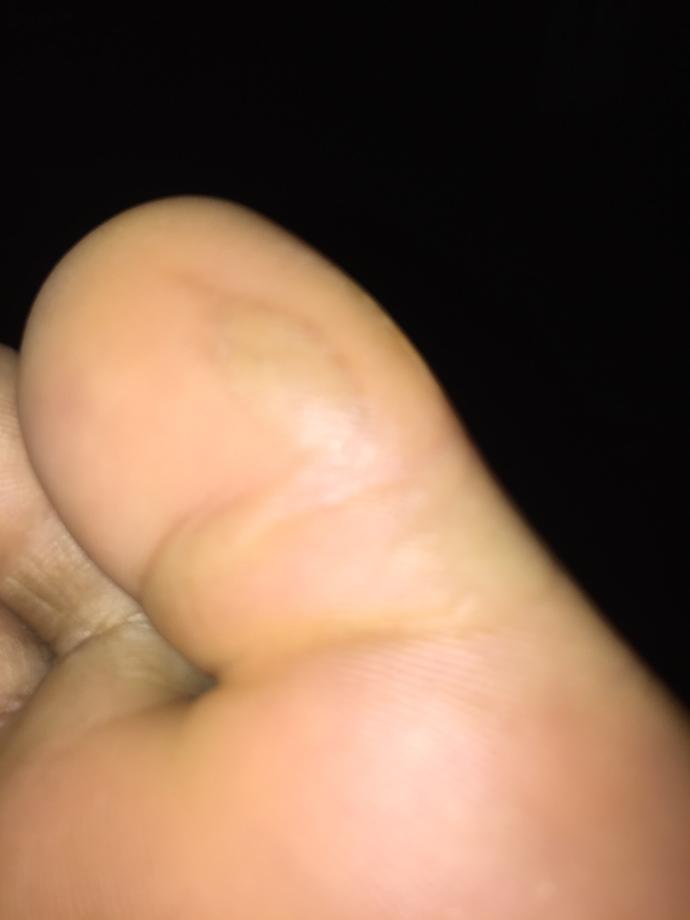 What is that and how do I get rid of it?