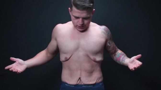 Girls, Would you ever date a guy with loose skin?