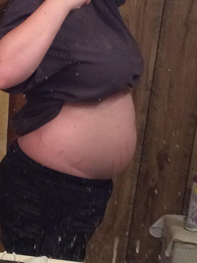 Do I look obese? (Pictures)?