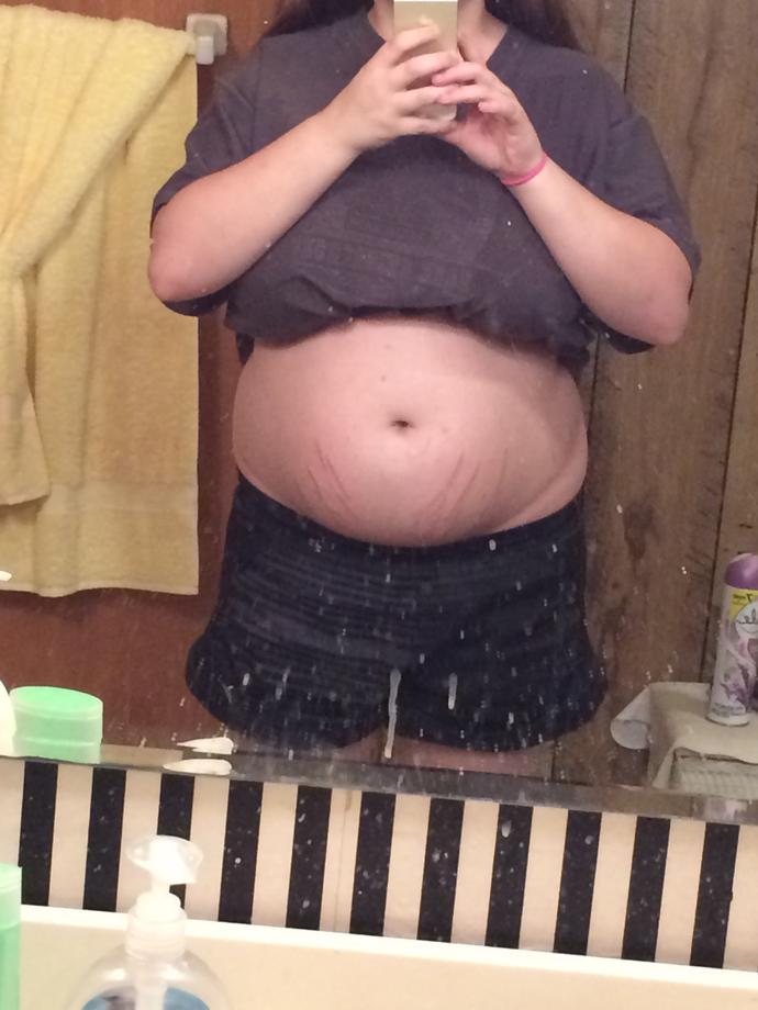 Do I look obese? (Pictures)?