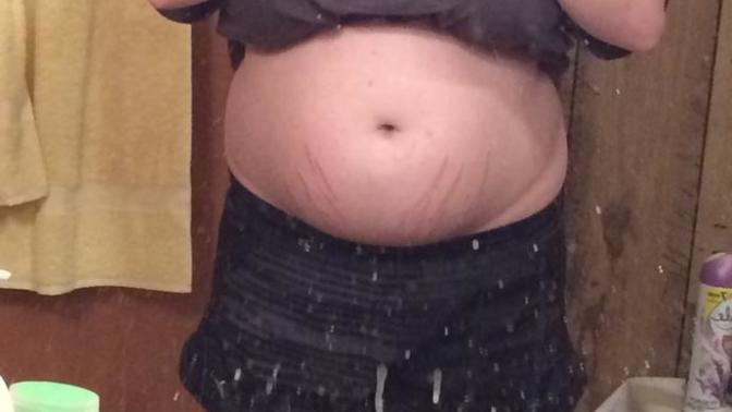 Do I look obese? (Pictures)?