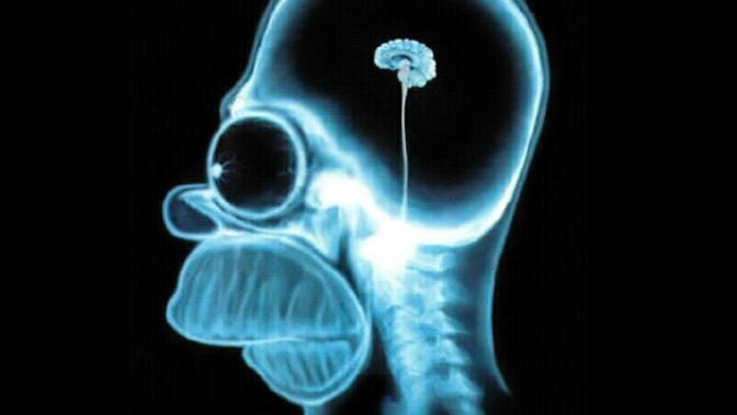 What would you do if your partner had a brain Xray and surprisingly their brain was no bigger than an acorn?