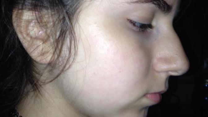 Guys, with a bad profile effect how you see a girl as attractive?