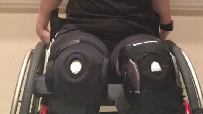 Guys, would you date a girl like me if my legs are like this?