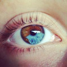 Do you have heterochromia?