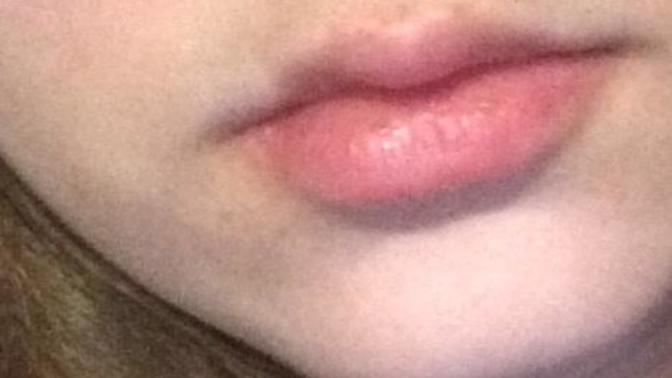 Do my lips look weird?