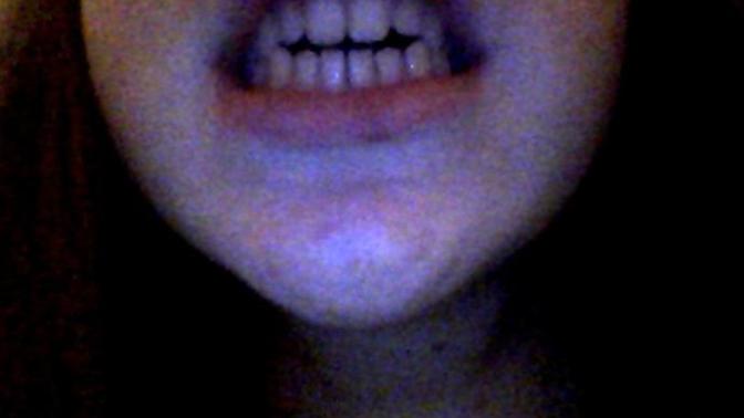 How do my teeth look?