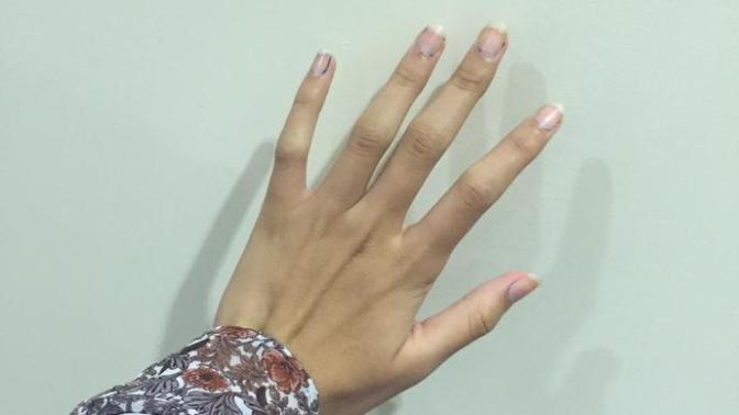 Is my hand ugly?