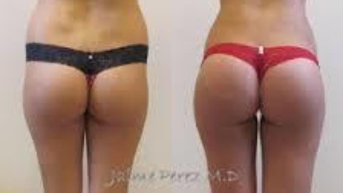Do squats make your butt bigger or make it Appear bigger by lifting it?