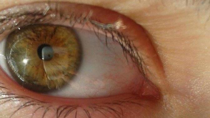 What colour are your eyes?