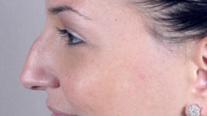 Are you attracted to aquiline ('big') noses?