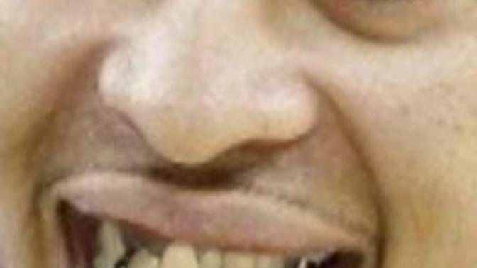Would you date a person with messed up teeth?