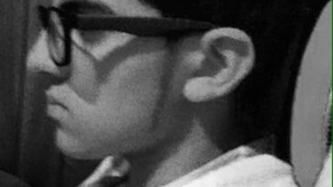 Guys, Why is my facial hair so pathetic?