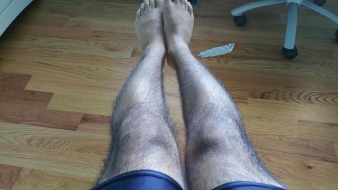 Are my arms and legs too hairy and should I trim them?