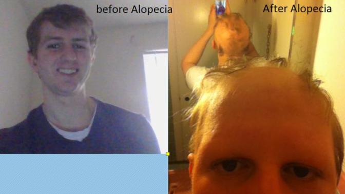 If girls say looks aren't important in a guy then how come I used to get asked out on dates in college&approached before I got Alopecia/ now I don't?