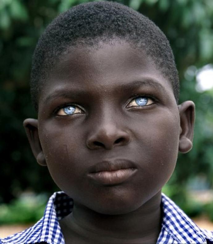 What's your first thought when you see black people with blue eyes?