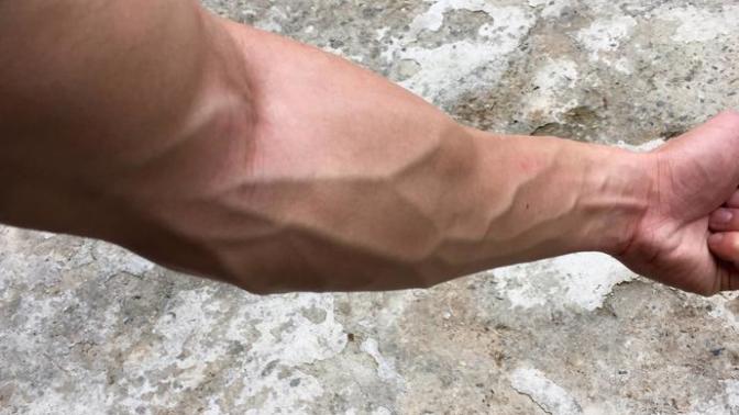 Do you have forearm veins?