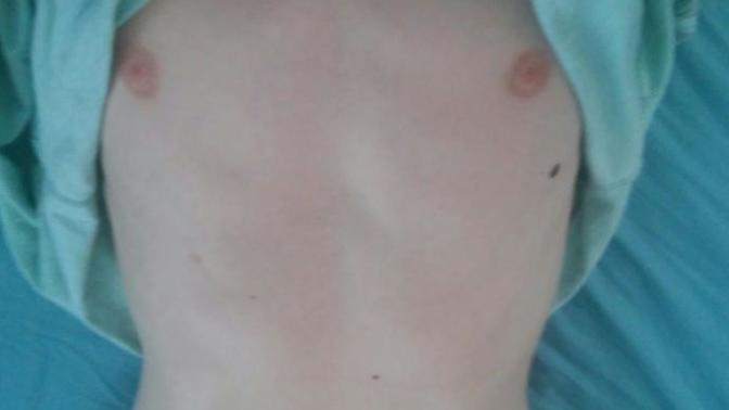 Do I look anorexic?