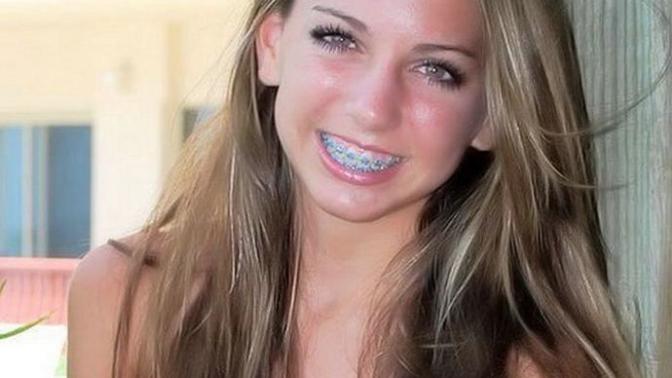 Gagers, do you think girls/guys looks cute with braces?