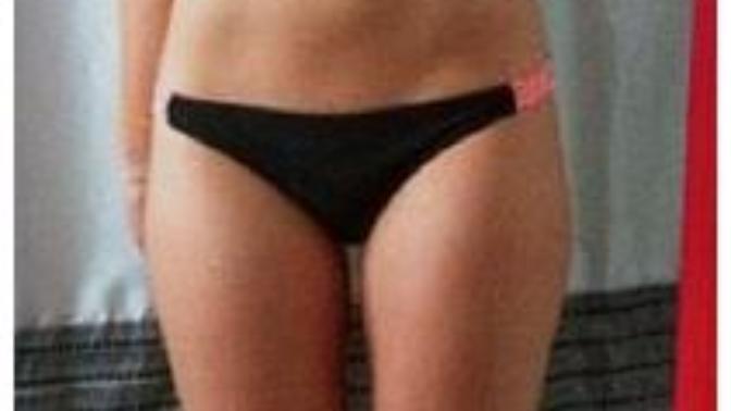 Do you think people use the terms normal weight, overweight, obese, and morbidly obese wrong?