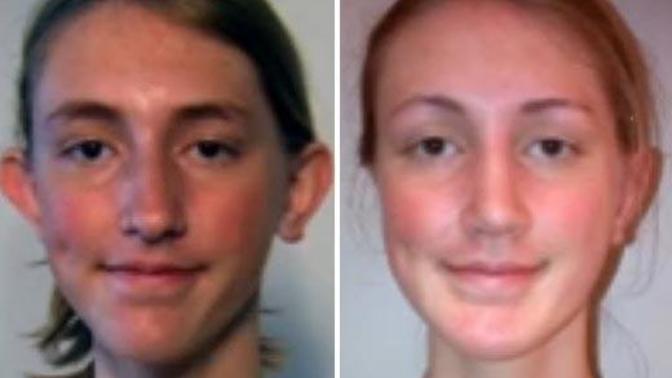Should bullied kids get plastic surgery?