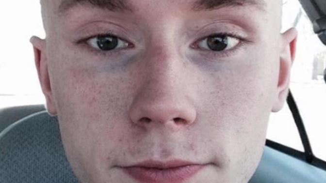 Girls, 18-24 would you be willing to a date a guy like me?