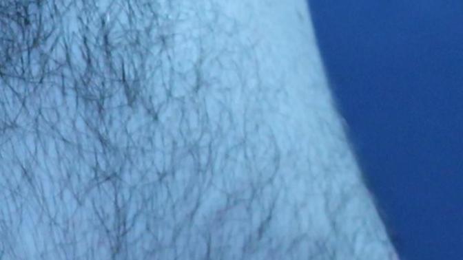 Is this gynecomastia a turnoff?
