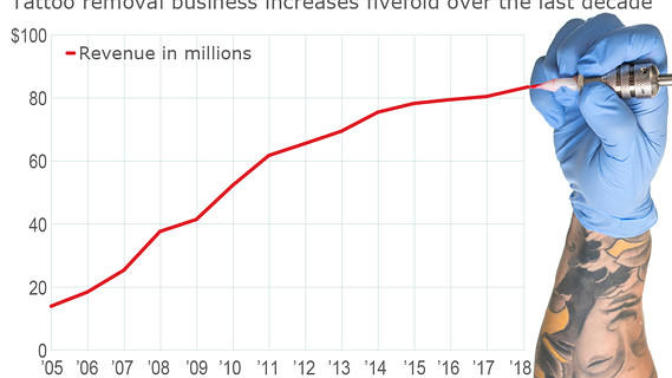 Why is the tattoo removal industry booming right now?