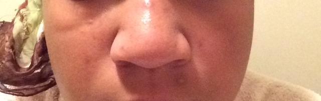 What can I do to get these dark marks off of my face?