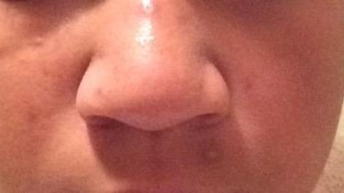 What can I do to get these dark marks off of my face?