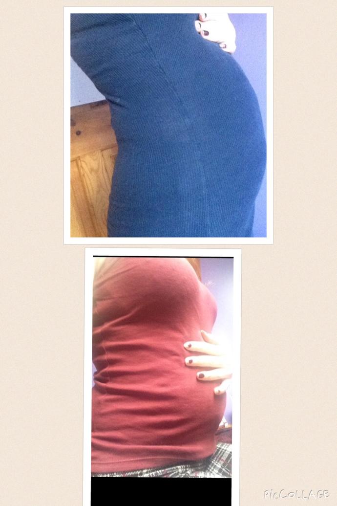 Woo! I'm pregnant! :) for fun, does the bump look like a boy or girl? 