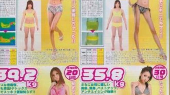 Is that anorexia?