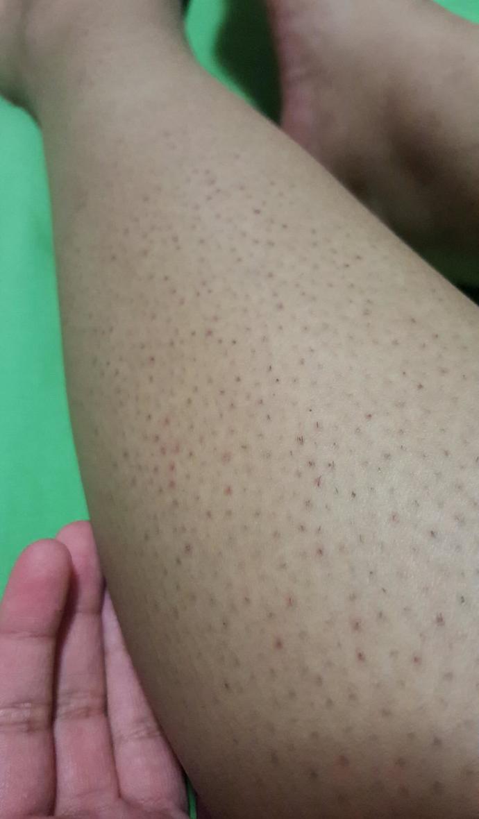 Leg shaving tips?