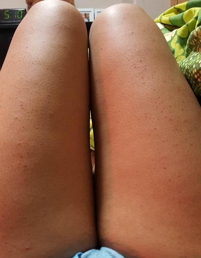 Leg shaving tips?