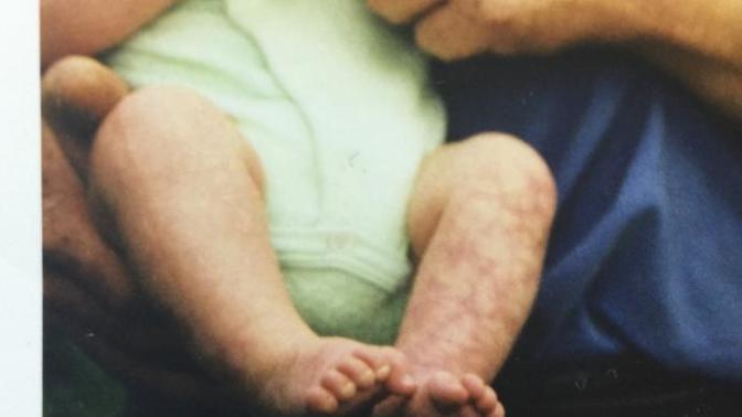 Very Rare skin disease. Very self conscious of my legs. Do they look okay to you?
