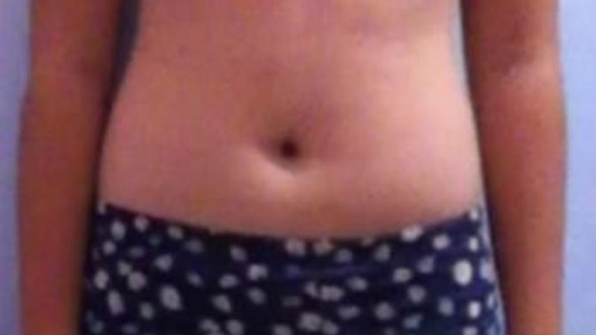 Am I too fat? I feel so fat. What should I do?