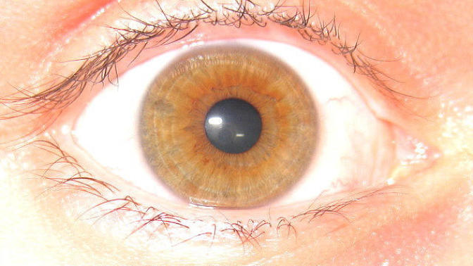 What color is this eye?