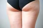 Guys, do you care about cellulite?